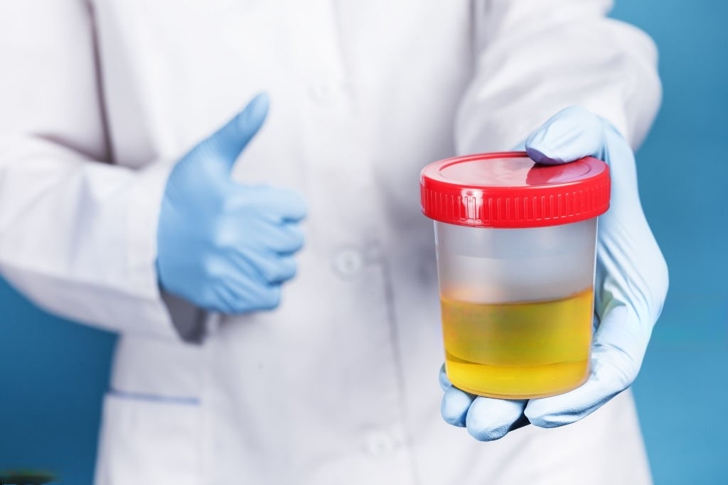 Synthetic Urine: TOP 5 Synthetic Urine Products to Pass a Drug Test -  PATMOORE FOUNDATION